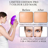 Limited Edition Pro 7 Colour LED Face & Neck Mask